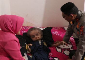 Bhayangkari Peduli, Sentuhan Kasih untuk Anak Penderita Hidrosefalus di Tarakan
